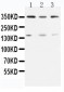 Anti-ATM Antibody